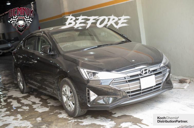 heavily weathered hyundai elantra 2021 is going to be detailed at demnok restorations